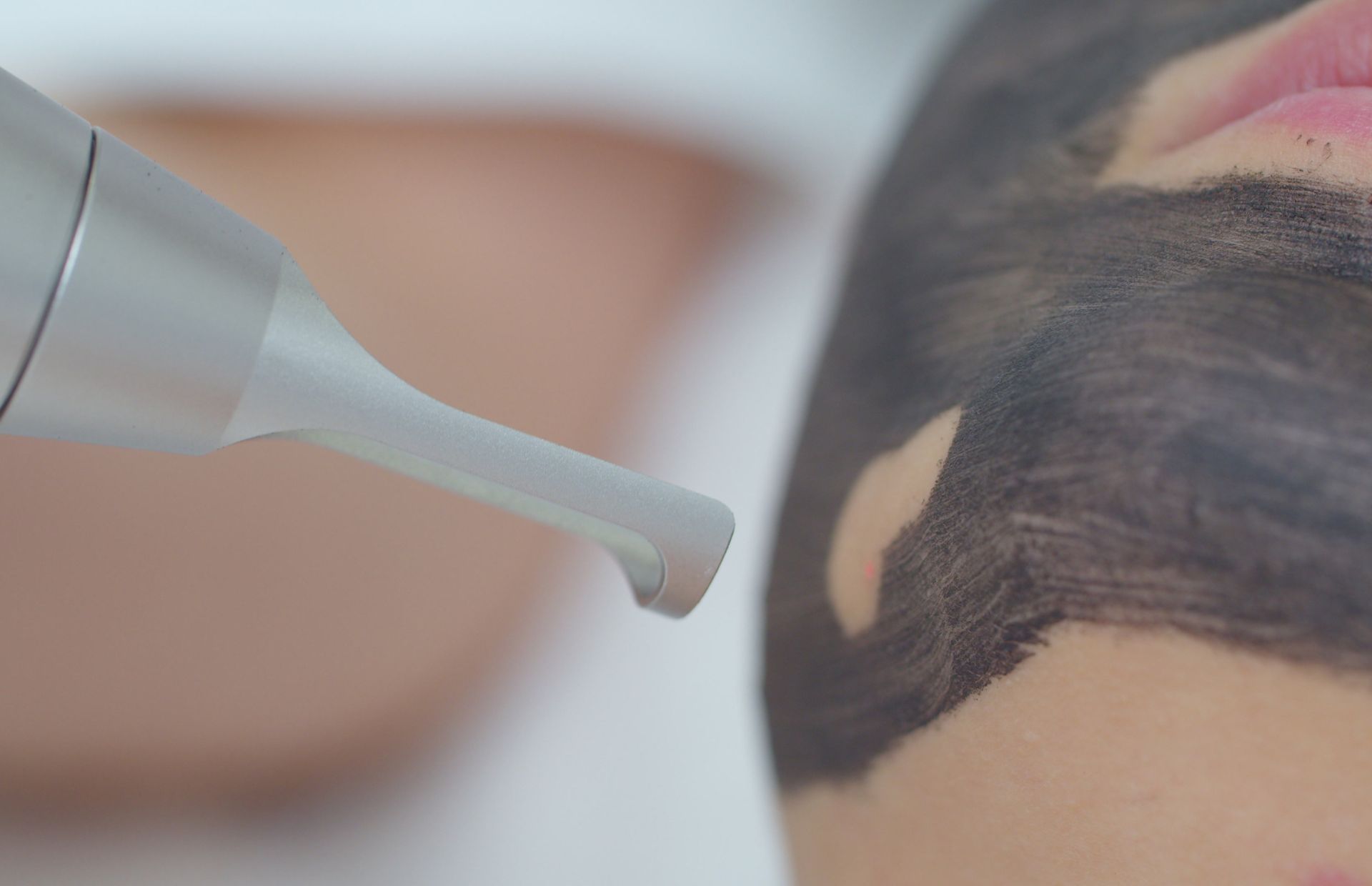 Kosmetische Laserbehandlung mit Maske und Yag-Laser