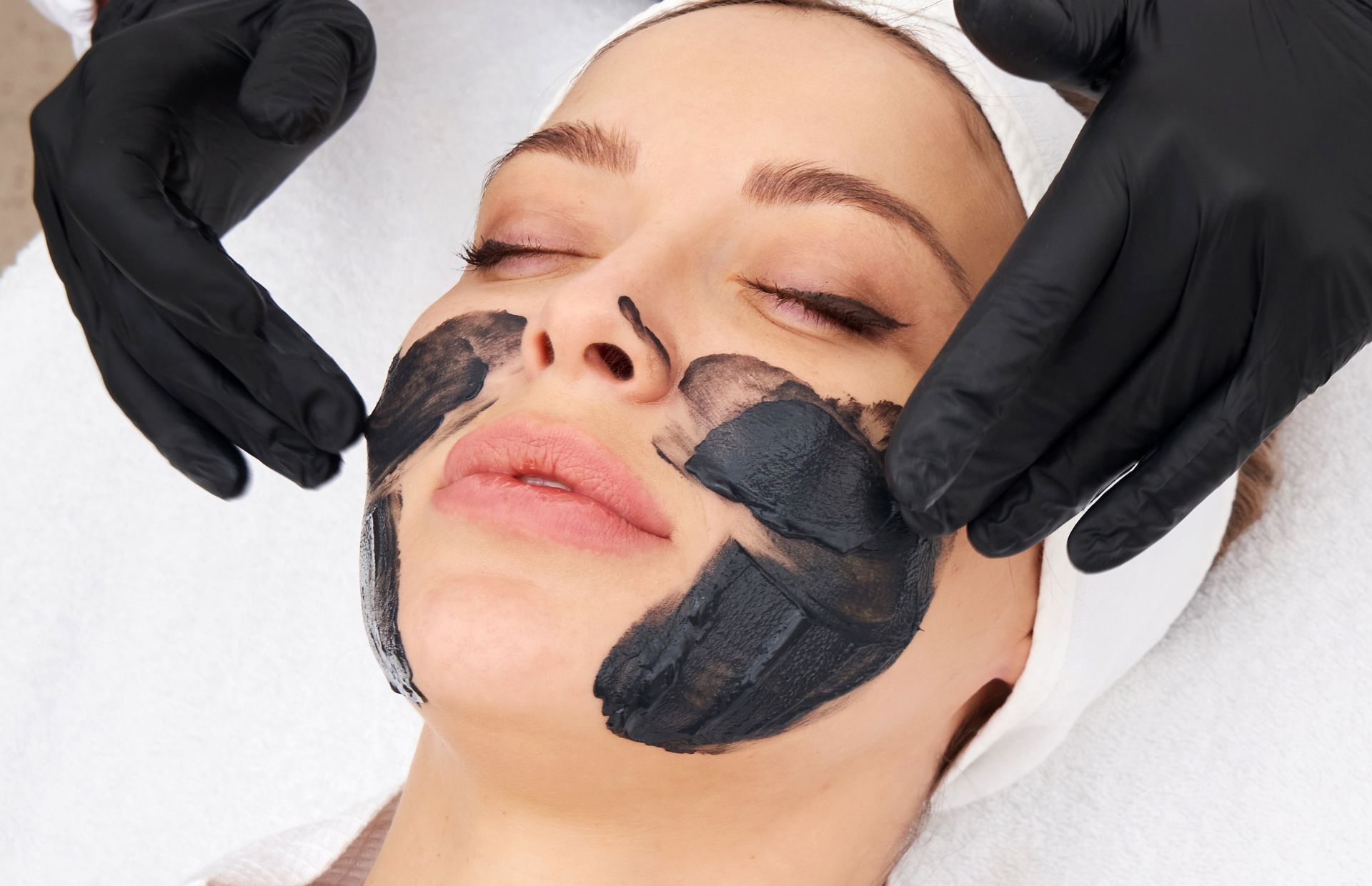 Carbon Peeling meni kosmetik